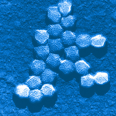 Adenoviruses (pictured here) may may be a cause of obesity
